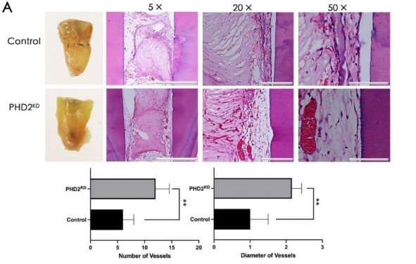 Tooth stem cells modified to mimic a cellular state similar to that under low oxygen (PHD2KD) gave rise to tooth pulp tissue with a significantly increased amount of blood vessels.
 